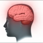 Living with Traumatic Brain Injury